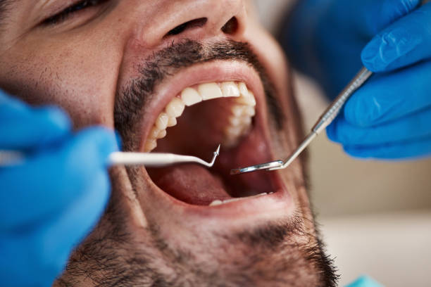 Trusted NJ Emergency Dental Service Experts